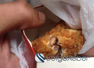 KFC-də böyük QALMAQAL: müştəriyə Qızardılmış SİÇAN satıldı: “Ağzımda tük və çox pis dad…” – FOTOLAR