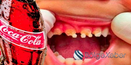 “Coca-Cola” – içki, yoxsa xəstəlik mənbəyi? (VİDEO)