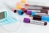 Koronavirusdan ölənlərin sayı artdı - Günün statistikası