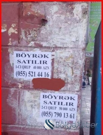 Bakı küçələrində insan böyrəyi satılır - Fotofakt