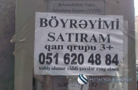 Böyrəyini satışa çıxaran şəxs danışdı - "Çox ucuz qiymətə satıram"