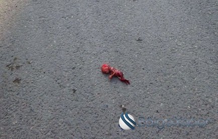 Bakının mərkəzində dəhşət: abort qalıqları yolun ortasına düşdü – FOTO + VİDEO (18+)