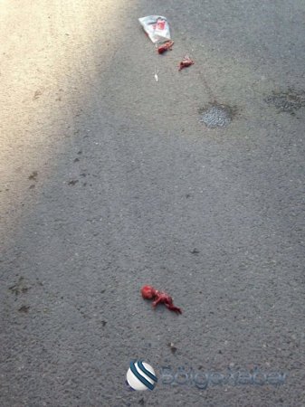 Bakının mərkəzində dəhşət: abort qalıqları yolun ortasına düşdü – FOTO + VİDEO (18+)