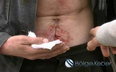 Nə baş verir: Bölmədə intihara daha bir cəhd - Özünü qarnından bıçaqladı