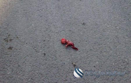 Bakının mərkəzində dəhşət: abort qalıqları yolun ortasına düşdü – FOTO + VİDEO (18+)