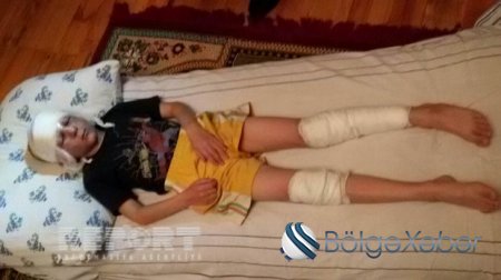 Tərtərdə hərbi sursat partlayıb, 8 yaşlı uşaq xəsarət alıb Tərtərdə hərbi sursat partlayıb, 8 yaşlı uşaq xəsarət alıb