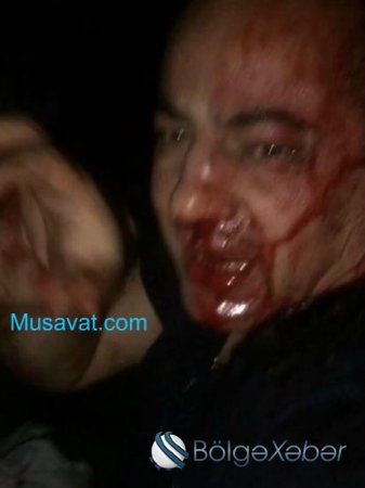 Azərbaycanlı "qanuni oğru"nu Türkiyədə vəhşicəsinə döydülər - FOTO Azərbaycanlı "qanuni oğru"nu Türkiyədə vəhşicəsinə döydülər - FOTO