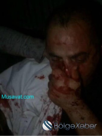 Azərbaycanlı "qanuni oğru"nu Türkiyədə vəhşicəsinə döydülər - FOTO Azərbaycanlı "qanuni oğru"nu Türkiyədə vəhşicəsinə döydülər - FOTO