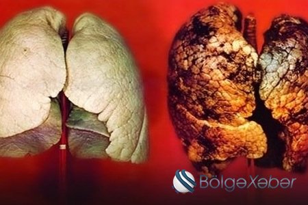Ağciyəri qorumaq üçün bunları yeyin