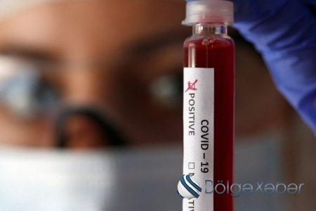 Ukraynadan Azərbaycana qayıdan 29 nəfərdə koronavirus aşkarlanıb