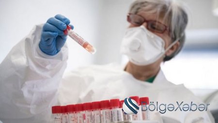 Azərbaycanda bu günə olan koronavirus statistikası