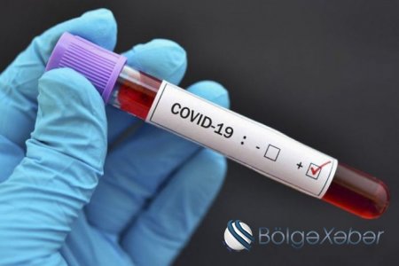Azərbaycanda koronavirusa yoluxanların sayı YENİDƏN AZALDI
