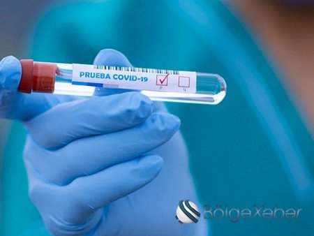 Azərbaycanda koronavirusa yoluxanların sayı azaldı