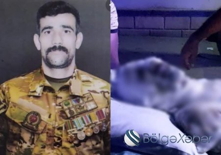 Özünü yandıran qazi vəfat etdi