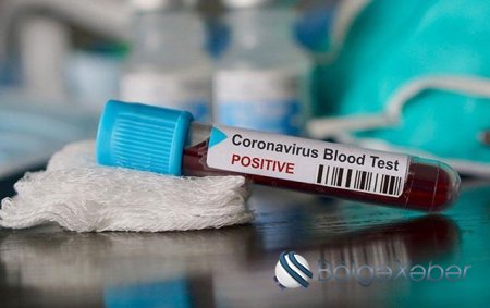 Azərbaycanda koronavirusa yoluxanların statistikası