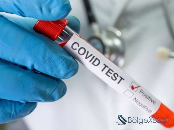 Bu müəssisələrə giriş zamanı COVID-19 testi tələbi ləğv edilir