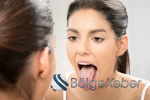 Diliniz sarıdırsa bunu mütləq oxuyun