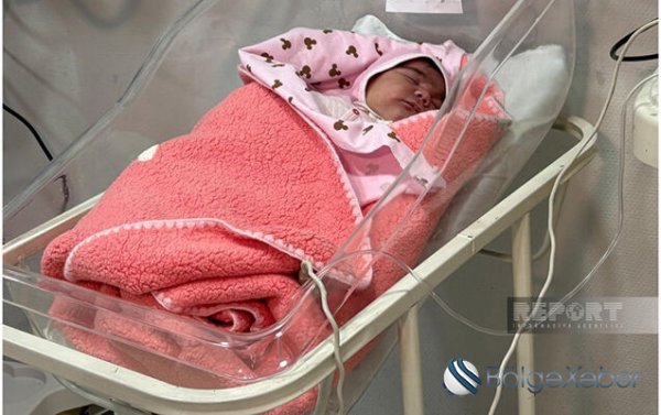 Azərbaycanda 6 kiloqramlıq körpə doğuldu
